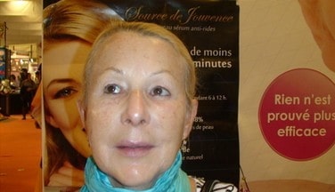 Après l'application des produits Jouvessence de PG Skincare France